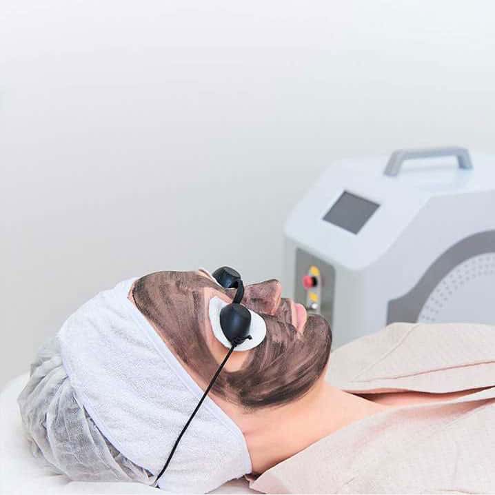 Carbon Laser Peel treatment in Hyderabad By Dr. Ravali