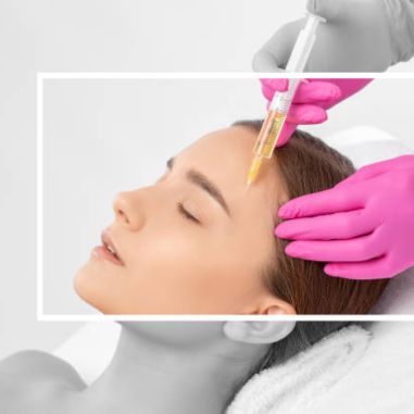 PRP treatment