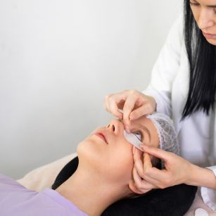 dark circles treatment in Hyderabad
