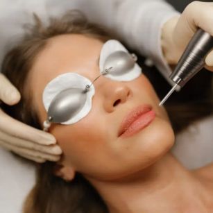 pigmentation removal treatment