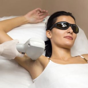 Laser toning for underarm pigmentation