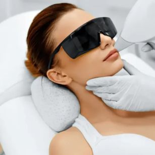laser hair removal