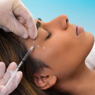 Botox treatment