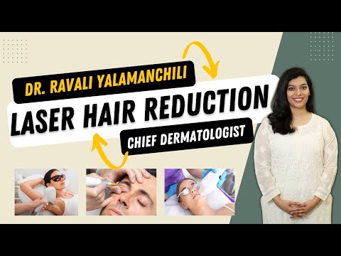 FAQs on Laser Hair reduction