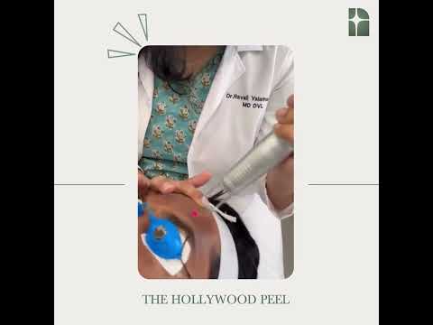 Hollywood Peel | NEYA skin clinic | Dr Ravali Yalamanchili