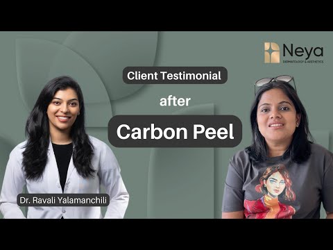 Happy client testimonial after carbon peel | Neya Skin Clinic | Dr Ravali
