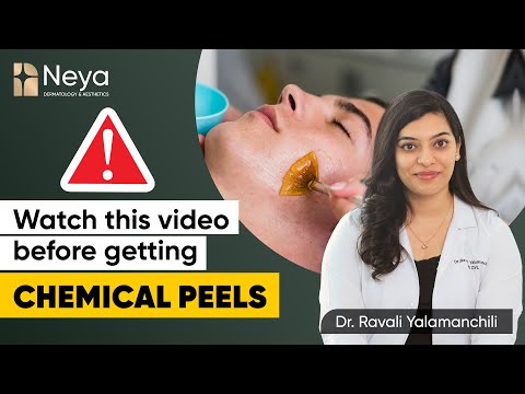 Myths and facts about Chemical Peels | Chemical peeling treatment | Neya clinic