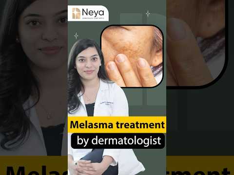Melasma treatment by Dermatologist | Melasma cream for face | Neya clinic