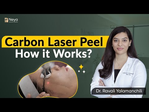 Carbon Laser peel treatment | Carbon laser peel treatment in hyderabad | Neya clinic
