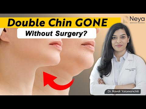 How to reduce chin fat? | HIFU Treatment in Hyderabad | Dr. Ravali Yalamanchili