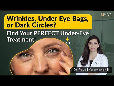 Under Eye Bags Treatment | How to treat Under eye Wrinkles
