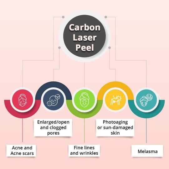 What Concerns can be Addressed by Carbon Laser Peel Treatment In Hyderabad?