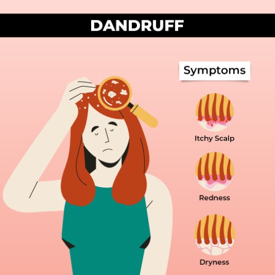 Signs and Symptoms of Dandruff: Itchy Scalp, Redness, Dryness