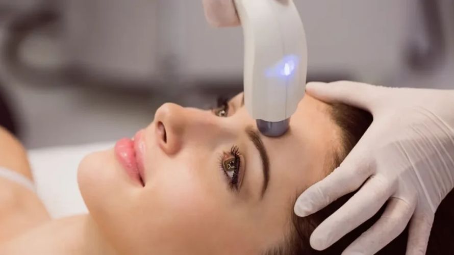 Melasma Treatment 