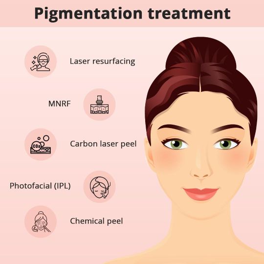 How can Hyperpigmentation be Treated? - Types of Pigmentation Treatment in Hyderabad: Laser Resurfacing, MNRF , Carbon Laser Peel